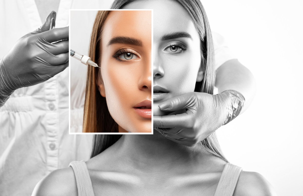Exosoemnbehandlung, Exossomentherapie, Körpereigen
hyaluron spritzen münchen
hyaluron faltenunterspritzung kosten
hyaluron unterspritzung münchen
filler behandlung münchen
hyaluron gesicht behandlung