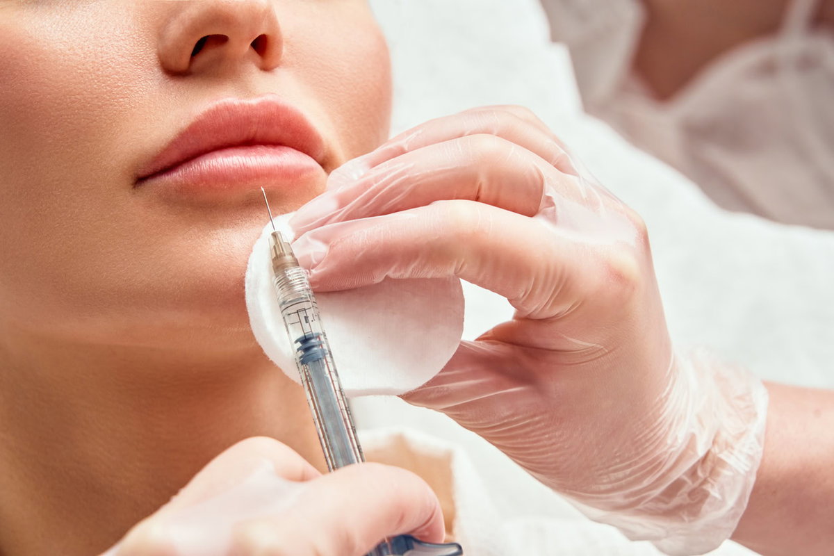 Lippenvergrößerung
Lippenunterspritzung
Lippen Filler
hyaluronsäure filler
lippen aufspritzen preise