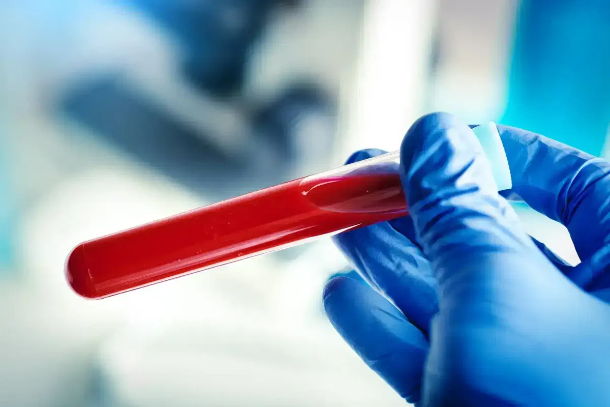 Kalium zu hoch? Ab wann gefährlich – Symptome, Messfehler & Medikamente