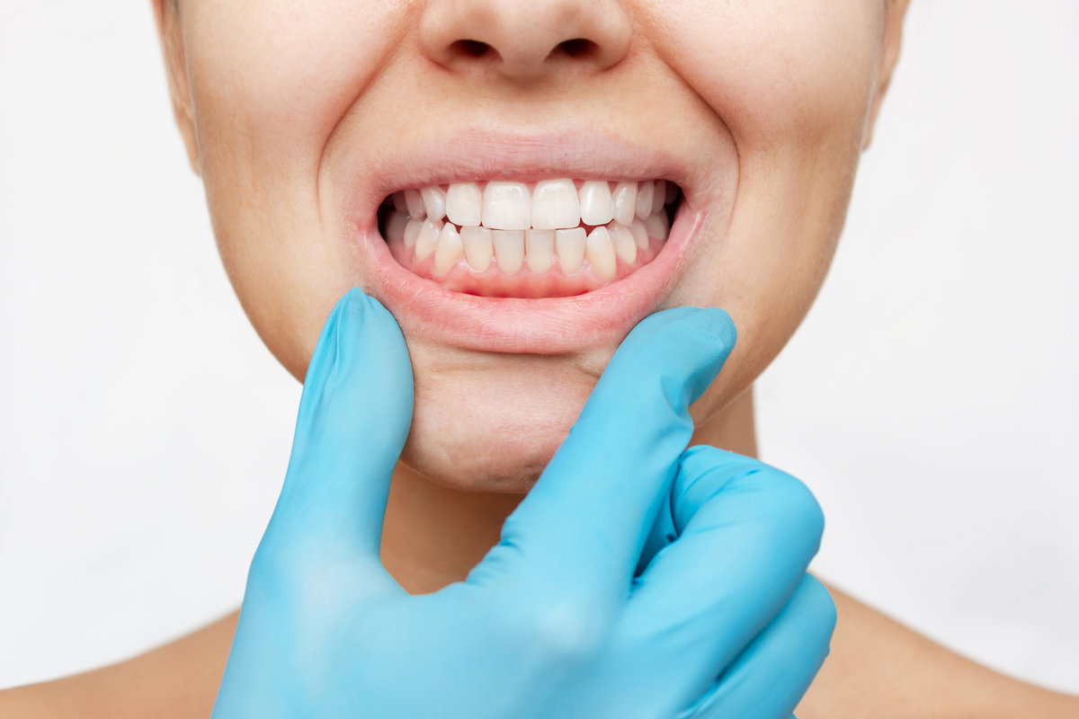 Untersuchung des Gebisses bei Verdacht auf Zähneknirschen