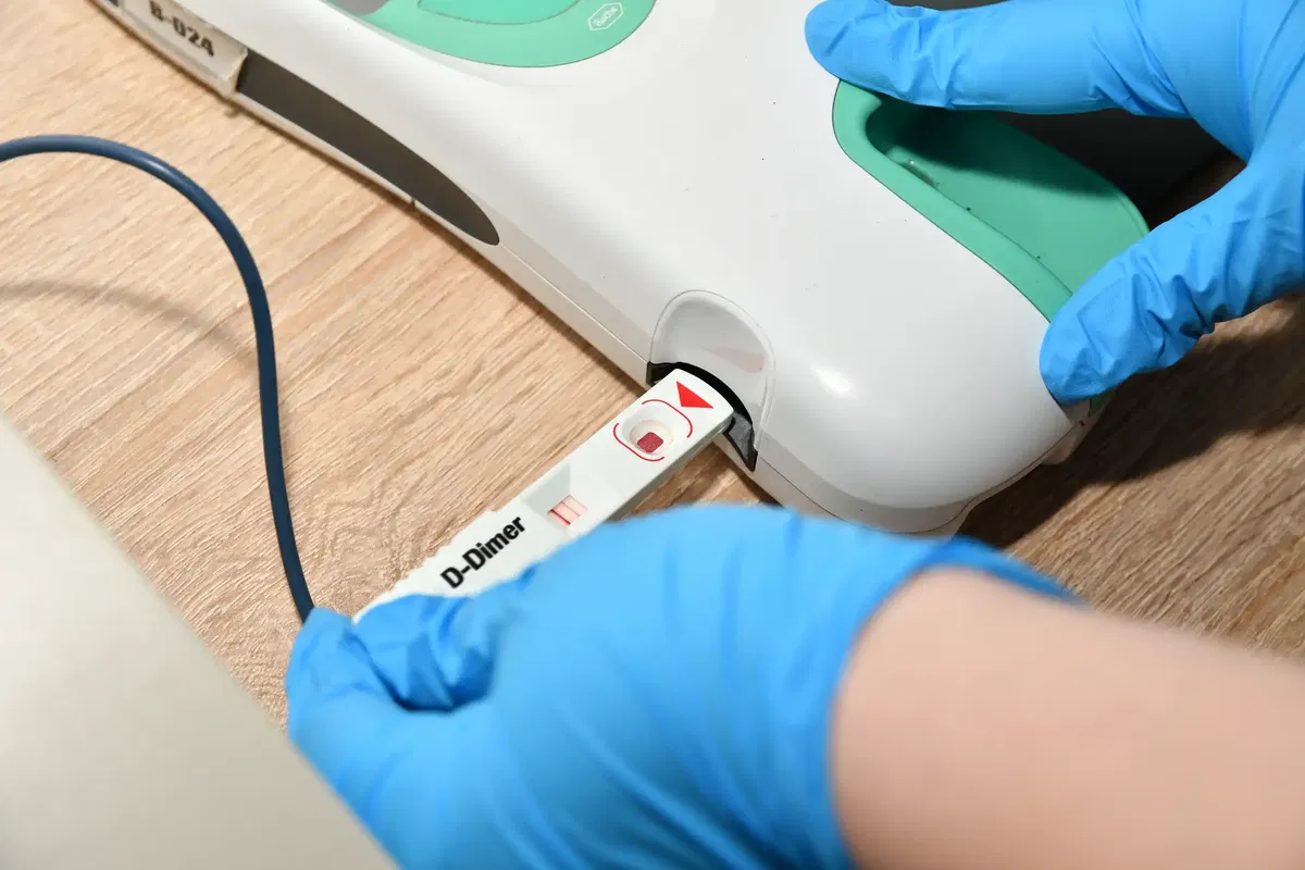 Diagnostik Hausarzt München: POCT-Schnelltestgerät in der Praxis für CRP und weitere Parameter