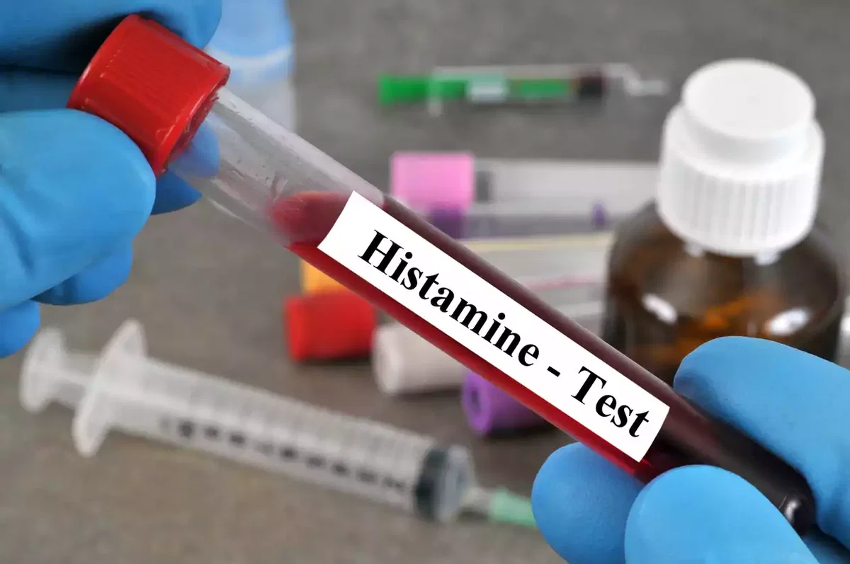 DAO-Test und Histaminintoleranz: Laborwerte im klinischen Kontext bewerten.