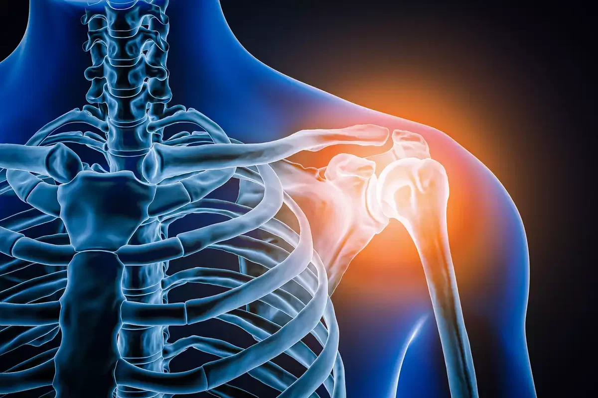Kalkschulter: Anatomie der Schulter und Rotatorenmanschette – Stoßwellentherapie (ESWT) München