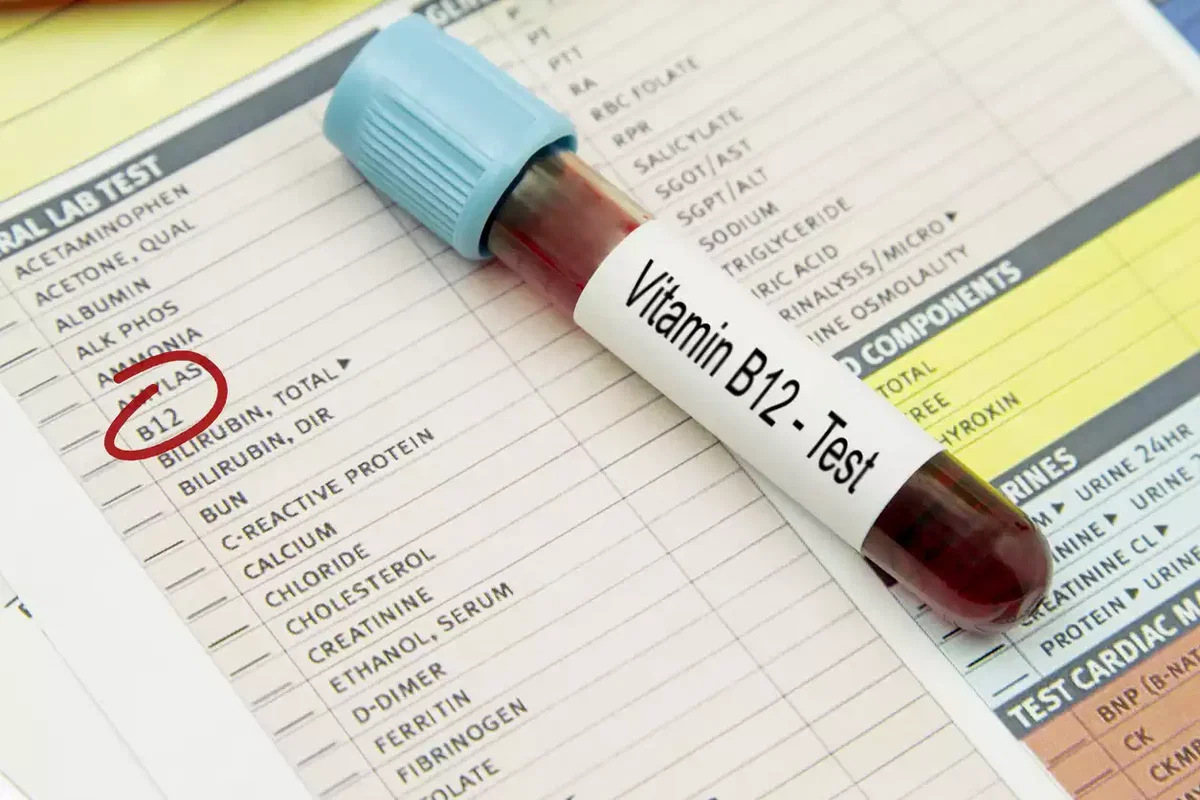 Vitamin-B12-Diagnostik mit Serum-B12, Holotranscobalamin und MMA