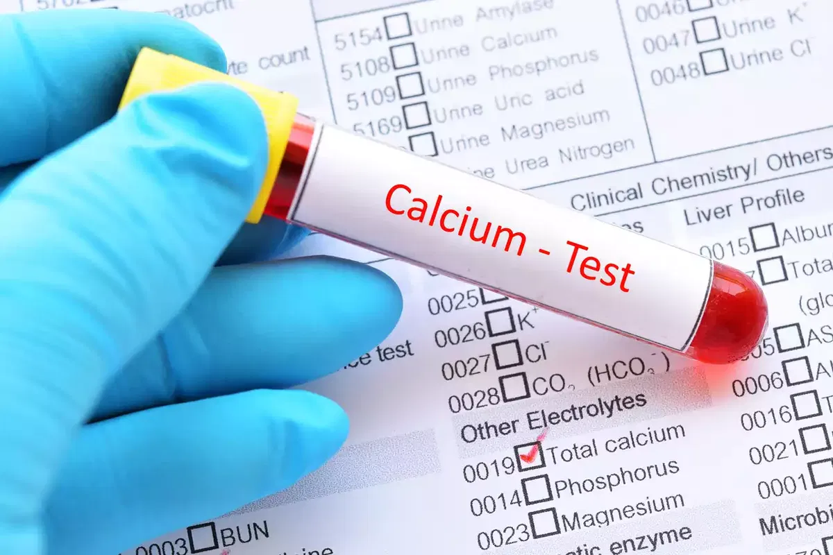 Calcium Bluttest im Röhrchen zur Labordiagnostik bei Calcium-Mangel, Knochenthemen und Muskelbeschwerden