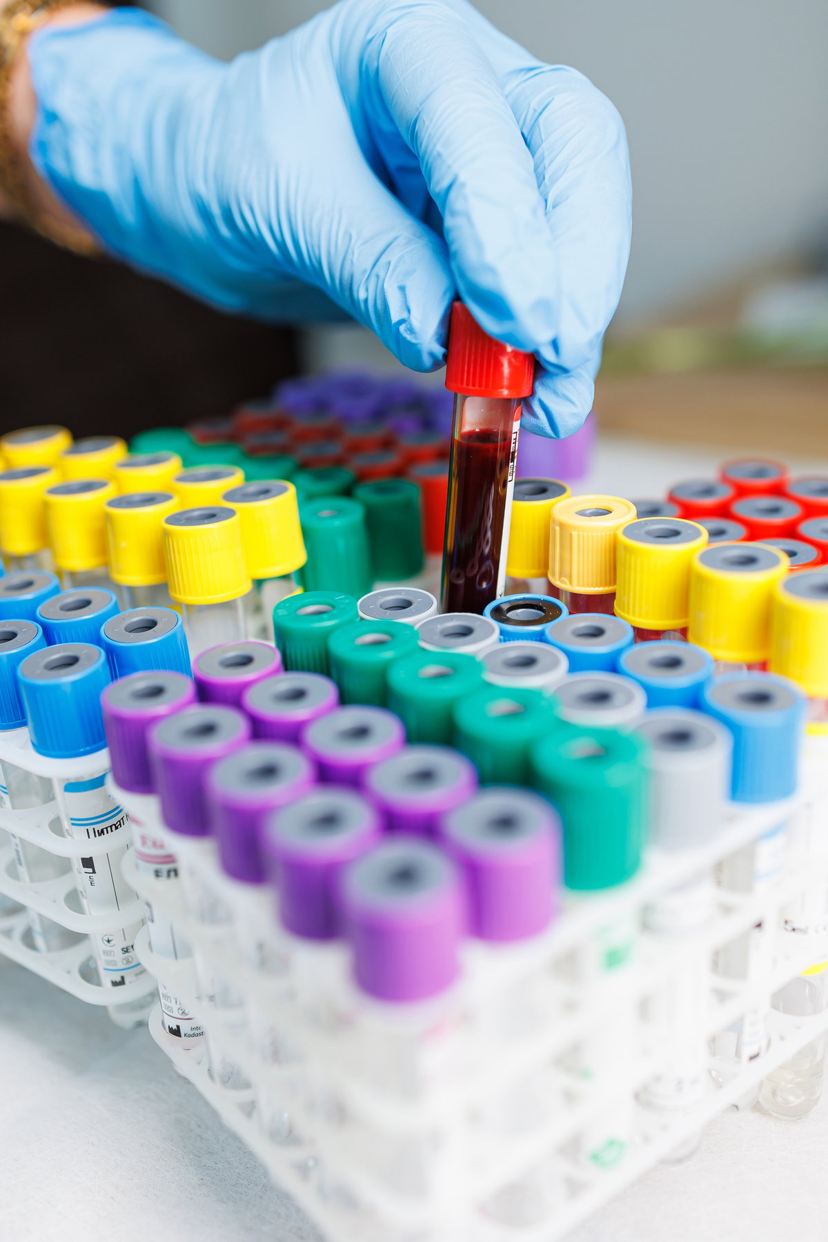 MCH, MCV und MCHC im Blutbild einfach erklärt