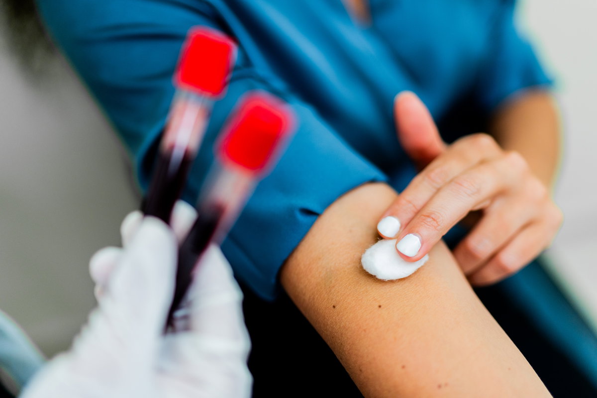 Blutentnahme zur Bestimmung der Schilddrüsenwerte TSH, fT4 und fT3